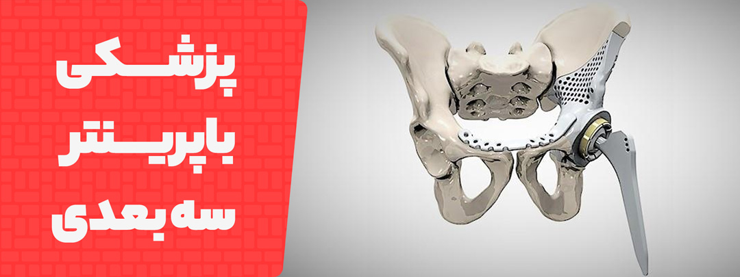 آینده پزشکی با پرینتر سه بعدی 