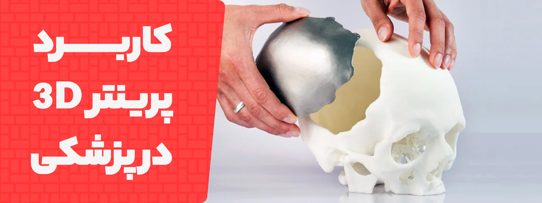کاربرد های پرینتر سه بعدی در پزشکی