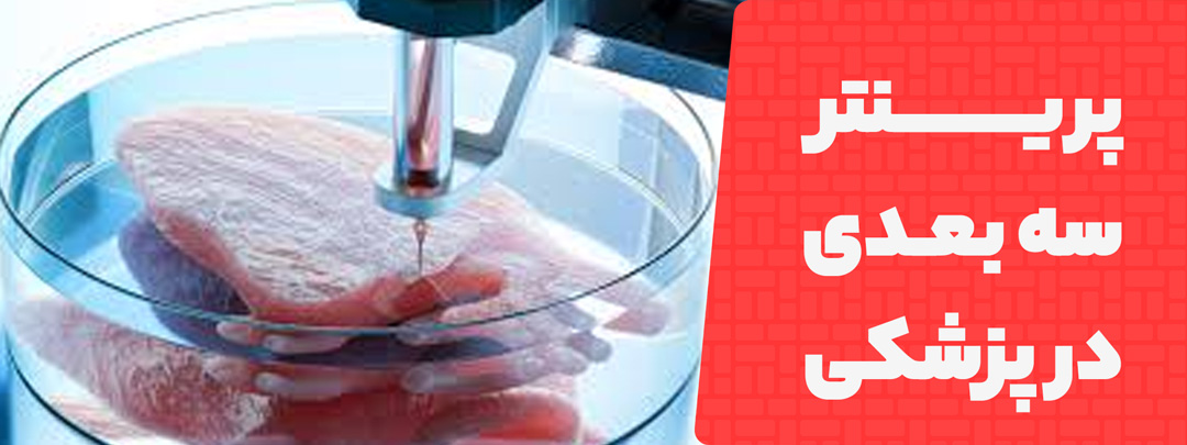 آینده صنعت پرینتر سه بعدی در پزشکی